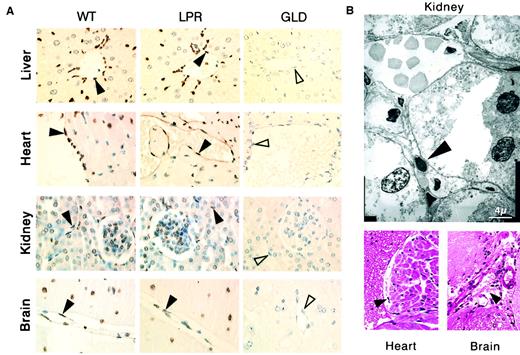Fig. 3. Systemic allogeneic immune responses induce disseminated vascular endothelial cell death. / (A) The TUNEL assay shows apoptosis (brown staining) of vascular endothelial cells (filled arrowheads) and additional cell types in tissue sections from liver, heart, kidney, and brain of immunodeficient SCID recipient mice killed 2 days after transfer of 108lymphocytes from allogeneic wild type (WT) mice or from allogeneic CD95-defective lpr (LPR) mice, whereas no apoptotic lesions were detected in SCID recipient mice 2 days after transfer of 108 lymphocytes from allogeneic CD95L-defectivegld (GLD) mice (the unstained endothelial cells are indicated by open arrowheads). (B) Endocardial lesions (heart) and subarachnoidal hemorrhage suffusions (brain), as well as typical electron microscopy features of endothelial cell apoptosis (kidney) were observed in SCID recipients killed 2 days after transfer of 108 lymphocytes from allogeneic wt mice (filled arrowheads).