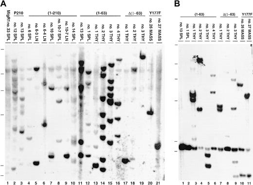 Fig. 9. Proviral integration and clonality of tumors. / (A) Proviral integration and (B) T-cell receptor (TCR) rearrangement. Genomic DNA (5 μg) from each indicated mouse tissue was digested with EcoRI and probed with either an IRES probe to detect proviral integration or TCR Jβ1 probe to detect TCR rearrangement status as previously described.1735 The λHindIII molecular weight marker is shown on the left.