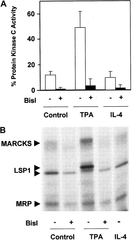 Fig. 1. Analysis of PKC activity in B-CLL cells. / (A) Membrane-associated PKC activity in particulate fraction. B-CLL cells were incubated for 10 minutes in the presence of 10 nM TPA for 20 minutes in the presence of 10 ng/mL IL-4 or in medium alone. After that time, cells were harvested and lysed, and the distribution of the enzyme between cytosolic fraction and particulate fraction was evaluated. PKC activity analysis was performed as described in “Patients, materials, and methods.” The cell extract was preincubated with 1 μM BisI for 20 minutes at room temperature before reaction was initiated. Values are mean ± SD for 6 different patients. Results are shown as the percentage of PKC activity present in the particulate fraction with respect to total PKC activity (cytosolic fraction plus particulate fraction). (B) Phosphorylation of PKC substrates in intact B-CLL cells. B-CLL cells were labeled with32P as described in “Patients, materials, and methods,” in the absence or the presence of 5 μM BisI. Then cells were incubated with 10 nM TPA or 10 ng/mL IL-4 for 10 and 20 minutes, respectively. The figure shows the results corresponding to 1 representative patient from 4 patients analyzed who had similar results.