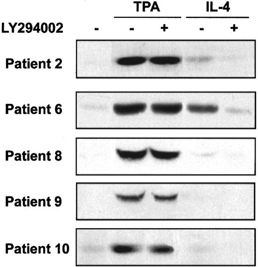 Fig. 6. Effect of TPA and IL-4 on Akt phosphorylation. / Cells from 5 representative patients were incubated with 20 μM LY294002 for 1 hour before the addition of 10 nM TPA or 10 ng/mL IL-4 to the culture. Akt phosphorylation in Ser473 was analyzed by Western blot 20 minutes after the addition of drugs.