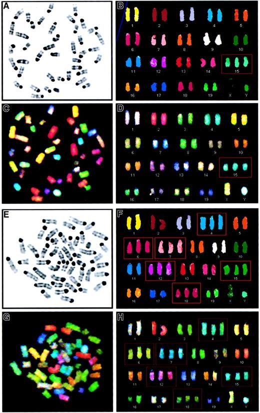 Fig. 2. SKY analysis of murine leukemias reveals a pattern of recurring numerical abnormalities. / (A-D). Metaphase cell from the spleen of a PML-RARA mouse with leukemia characterized by trisomy 15 as the sole abnormality (case 1950, 41,XY,+15). (A) Inverted image of the metaphase cell counterstained with 4,6-diamidino-2-phenylindole-dihydrochloride (DAPI). (B) Karyotype of the classified image. (C) Spectral image of the metaphase cell. (D) Karyotype of the spectral image. Trisomy for chromosome 15 is identified by a red box. (E-H). Metaphase cell from the spleen of a PML-RARA/BCL2 mouse with leukemia characterized by a hyperdiploid karyotype with trisomy for chromosomes 4, 6, 7, 12, 15, and 18 (case 67, 46,XY,+4,+6,+7,+12,+15,+18). (E) Inverted image of the DAPI-stained metaphase cell. (F) Karyotype of the classified image. (G) Spectral image of the metaphase cell. (H) Karyotype of the spectral image. Trisomic chromosomes are identified by a red box.