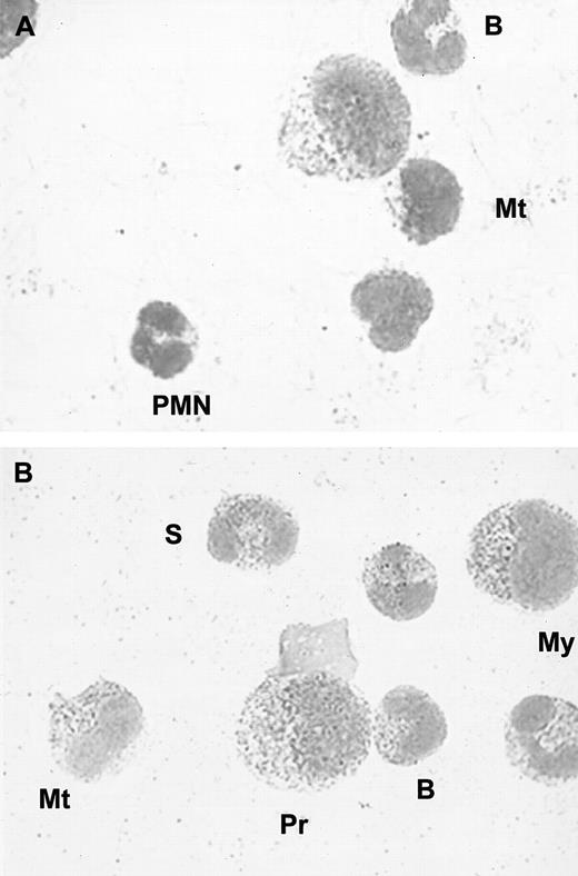 Fig. 5. Immunocytochemical staining of bone marrow cells. / (A) Negative control; no staining was observed with a control immunoglobulin. (B) Intracellular red staining was observed with specific monoclonal anti-HGF antibodies; (Pr indicates promyelocyte; My, myelocyte; Mt, metamyelocyte; B, band cell; S, segmented cell). Smears were examined by light microscopy at × 800.