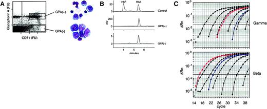 Fig. 5. HbA and HbF and mRNA content among sorted erythroid human bone marrow populations. / (A) Bone marrow mononuclear cells were stained and sorted using the flow cytometric gates of CD71+ , GPA− cells versus CD71+, GPA+ (rectangles). Stained cytospins of the postsort populations are shown on the right. (B) HPLC analyses of the control HPLC (top) showing the elution times of HbF and HbA versus sorted GPA+ cells (middle) and GPA−cells. Note differences in millivolt (mV) scales. (C) Quantitative PCR analyses of globin mRNA. Amplification curves of standard plasmid dilutions containing γ-globin (upper panel) and β-globin (lower panel) are shown in black. Amplification curves from total RNA extracted from the GA+CD71− cells are shown in blue, while GA+CD71+-derived curves are shown in red. Increases in the amount of template mRNA molecules were detected by a decrease in the number of PCR cycles required to reach the emission intensity threshold level of 0.02 (bold horizontal line). ΔRn = fluorescence emission intensity.