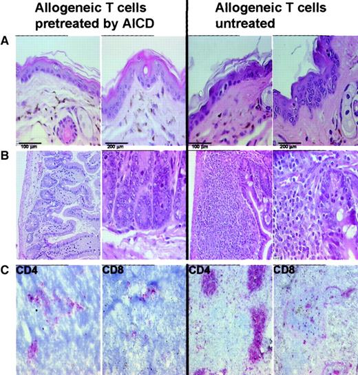 Fig. 6. Histologic examination of GvHD. / Induction of lethal acute GvH reactions after adoptive transfer of allogeneic donor T lymphocytes or donor T cells depleted of alloreactivity by AICD was examined histologically and by immunohistology as described in “Materials and methods.” On day 6 after transfer, 2 mice from each group were killed and tissue from skin, liver, spleen, small intestine, and lymph nodes was fixed or embedded. Depicted are sections of skin (A) and small intestine (B) (magnifications of 100 μm and 200 μm) stained by hematoxylin and eosin, which show cells in the basal layer of the epidermis undergoing apoptosis and lymphocytic infiltrations into the cryptic epithelium of small intestine following adoptive transfer of allogeneic donor cells. In addition, immunohistology (shown in red) revealed massive expansion of CD4+ T cells and, albeit to a lesser extent, of CD8+ T cells in spleen (C) isolated from F1recipients that had received untreated allogeneic donor T cells. In contrast, no significant GvHD histopathology could be detected in recipients administered donor T lymphocytes subjected to AICD prior to transfer.