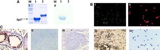 Fig. 1. (A) Western blot analysis confirming the successful generation of Sp17 mouse monoclonal antibodies, showing binding of the antibodies to a recombinant Sp17 protein and not to a control recombinant protein. Both recombinant proteins were Escherichia coli–derived and contained a C-terminal 6-His tag. (i) Coomassie blue staining of a 10% sodium dodecyl sulfate–polyacrylamide gel. (ii) Western blot analysis demonstrating the binding of Sp17 mouse monoclonal antibodies to only recombinant Sp17 protein (M = molecular weight marker; lane 1 = recombinant Sp17 protein; lane 2 = control recombinant protein). (B) Sp17 protein was detected on normal spermatozoa (i and iii) but not on any of the peripheral blood leukocytes (ii and iv) by either immunofluorescence cytology (i and ii) or immunocytochemistry (iii and iv). (C) Immunohistochemistry showing the expression of Sp17 protein in normal testis (i). In contrast, Sp17 protein was not detected in either normal tonsils (ii) or Peyer patches (iii).