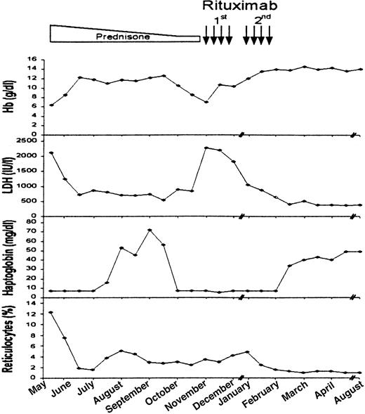 Fig. 1. Clinical course of the patient and response to treatment. / Changes in hemoglobin, LDH, haptoglobin levels, and reticulocyte count after initial rituximab therapy. Rectangle represents treatment with corticosteroids. Black arrows represent single rituximab infusions.