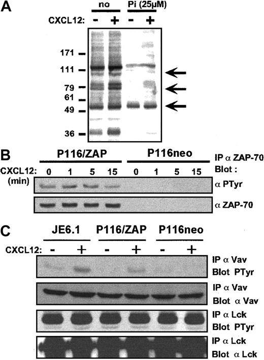Fig. 4. CXCL12 induces tyrosine phosphorylation of ZAP-70 and Vav1. / (A) Jurkat cells were preincubated for 3 hours in the presence of the carrier alone or of the ZAP-70 inhibitor piceatannol (25 μM) and were stimulated with CXCL12 (50 ng/mL) for 1 minute at 37°C. Antiphosphotyrosine immunoblot analysis was then performed on total cell lysates. (B) Immunoprecipitations with anti–ZAP-70 antibody followed by antiphosphotyrosine immunoblot analysis was performed on ZAP-70+-P116 and P116 cells activated by CXCL12 (50 ng/mL) for the indicated periods of time. The membrane was then stripped and reblotted with an anti–ZAP-70 antibody. (C) Immunoprecipitations with anti-Vav1 and anti-Lck antibodies, followed by antiphosphotyrosine immunoblot, were performed on Jurkat, ZAP-70+-P116, and P116 cells activated by CXCL12 (50 ng/mL) for 1 minute. Membranes were stripped and reblotted with anti-Vav1 and anti-Lck antibodies.
