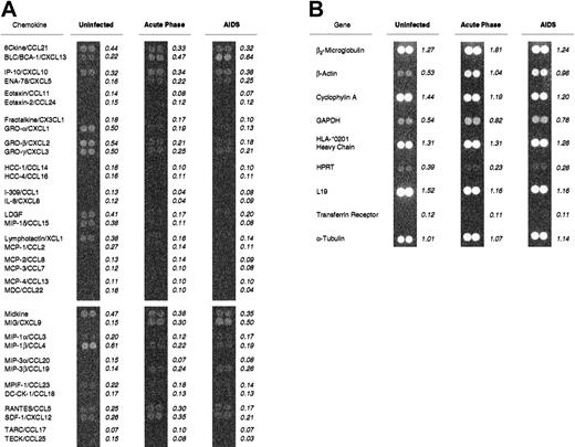 Fig. 1. DNA array hybridization determination of chemokine mRNA expression levels in rhesus macaque spleen tissues during SIV infection. / Total RNAs were purified from snap-frozen spleen samples obtained at necropsy and pooled according to disease state. Complementary DNA labeled with 33P–deoxycytidine triphosphate and reverse transcribed from each pool was hybridized to the human cytokine arrays, washed, and exposed to a high-resolution phosphorimaging screen. (A) The indicated values for each chemokine mRNA represent the mean signal intensity per pixel for the duplicate spots, after subtraction of local background and normalization against the mean signal intensity per pixel for 9 housekeeping genes (B). The uninfected pool included macaques M5600 and M6600; the acute-infection pool included M5499, M5699, M0999, M5899, and M5999; and the AIDS pool included M1799 and M5199. The new nomenclature for chemokines3 is shown here as the second part of each name.