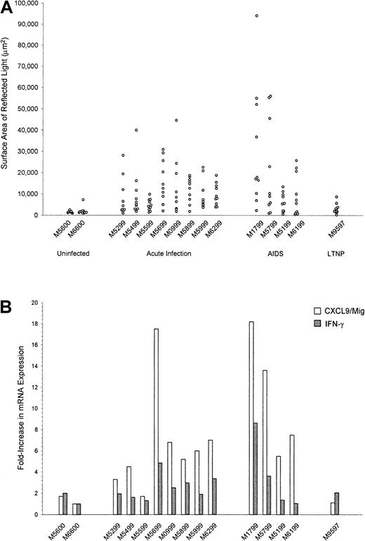 Fig. 3. Quantitation of CXCL9/Mig mRNA expression in spleen tissues from rhesus macaques by image capture and analysis and real-time RT-PCR. / (A) Quantitative image capture and analysis was used to determine the signal intensities after ISH for CXCL9/Mig mRNA in spleen tissue sections from rhesus macaques that were either uninfected or had the indicated stage of SIV disease. Each data point represents the surface area of reflected light determined for an individual 20 × microscopic field from the same tissue section after subtraction of the surface area of reflected light determined for a tissue section hybridized in parallel with the corresponding sense control probe. The values in each vertical collection of data points are from an individual animal. The differences in CXCL9/Mig expression were significant for both the acute infection (P = .005) and AIDS (P < .001) spleen measurements compared with uninfected spleen measurements. (B) Real-time RT-PCR was used to determine the relative levels of expression of CXCL9/Mig and IFN-γ mRNA in snap-frozen spleen tissue specimens, normalized against an endogenous control, β-GUS. The data were further normalized by using values from an uninfected macaque (M6600) for calibration.