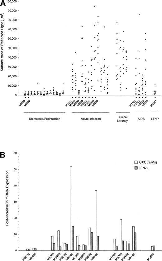 Fig. 4. Quantitation of CXCL9/Mig mRNA in lymph node tissues from rhesus macaques by image capture and analysis and real-time RT-PCR. / Quantitative image capture and analysis (A) and real-time RT-PCR (B) were used to determine CXCL9/Mig expression levels in lymph node specimens, as described in the legend for Figure 3. The levels of expression of IFN-γ mRNA as assessed by real-time RT-PCR are also presented in panel B. The 15 specimens obtained at necropsy are indicated by the asterisks in panel A. All differences in CXCL9/Mig expression measured by image capture and analysis were significant (P < .001) for the acute infection, clinical latency, and AIDS values compared with values in uninfected animals.