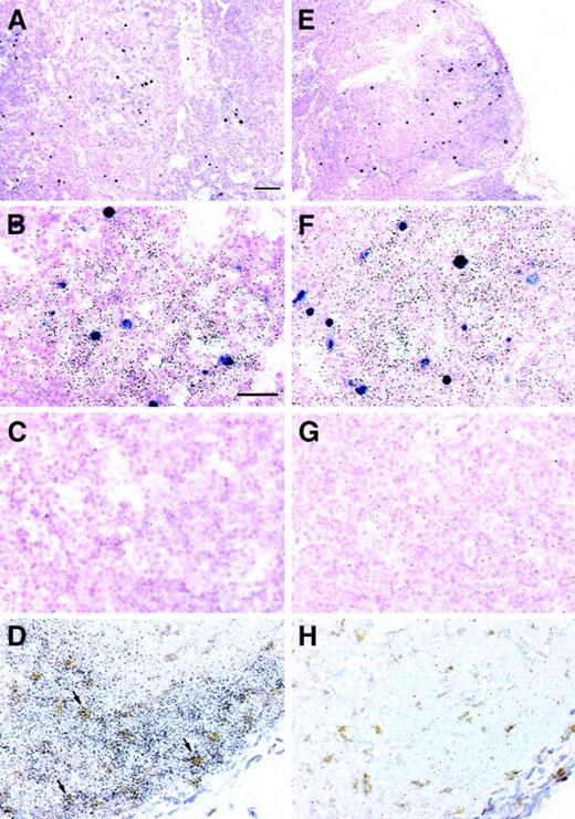 Fig. 5. Colocalization of CXCL9/Mig mRNAs with SIV virion RNA+ cells and CD68+ monocytes/macrophages in lymph nodes from rhesus macaques. / Lymph node tissue sections from macaques in the acute phase of infection (A-C, M5299) or AIDS (E-G, M5199) were hybridized in situ simultaneously with a 35S-labeled riboprobe specific for CXCL9/Mig and a pool of digoxigenin-labeled riboprobes specific for SIV. SIV viral RNA+ cells appear purple, whereas the CXCL9/Mig signal is a more diffuse distribution of black silver grains. Autoradiographic exposure times were kept to 2 days to maintain visualization of the SIV viral RNA+ cells in a lower plane of focus. Parallel simultaneous ISH with the sense control probes are shown for comparison (C,G). Lymph node tissue sections from a macaque with AIDS (M5199) were simultaneously hybridized in situ with a CXCL9/Mig-specific, 35S-labeled riboprobe and stained immunohistochemically for the monocyte/macrophage marker, CD68 (D). ISH signal is the diffuse distribution of black silver grains, whereas the CD68 signal is the deposition of an insoluble brown precipitate. Arrows indicate several double-positive cells. ISH with the sense control probe, with simultaneous staining for CD68, is shown in panel H. The bar in panel A is equivalent to 100 μm and applies to panels A and E. The bar in panel B is equivalent to 40 μm and applies to panels B-D and F-H. Sections were counterstained with nuclear fast red (A-C, E-G) or hematoxylin (D, H). Original magnifications, × 100 (A, E) and × 400 (B-D, F-H).