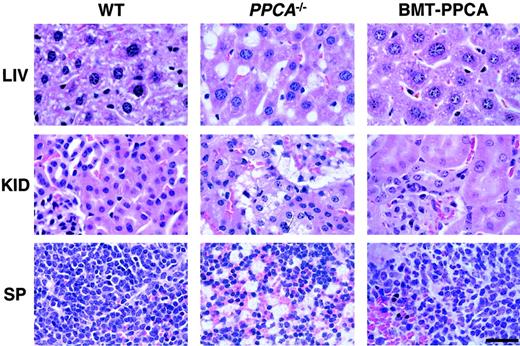 Fig. 2. Histology of systemic organs from BM-transplanted GS mice. / Organs from PPCA−/−mice transplanted with total −/−BM transduced with the MSCV-PPCA (BMT-PPCA) retrovirus were isolated at different time points after treatment. Hematoxylin and eosin-stained tissue sections of the liver (LIV), kidney (KID), and spleen (SP) from a BMT-PPCA–treatedPPCA−/−mouse killed at 9 months after treatment, and from age-matched wild-type andPPCA−/−mice revealed the complete restoration of normal tissue morphology with BM expressing PPCA, compared to the extensive vacuolation present in thePPCA−/−control mouse. Size bar corresponds to 30 μm.