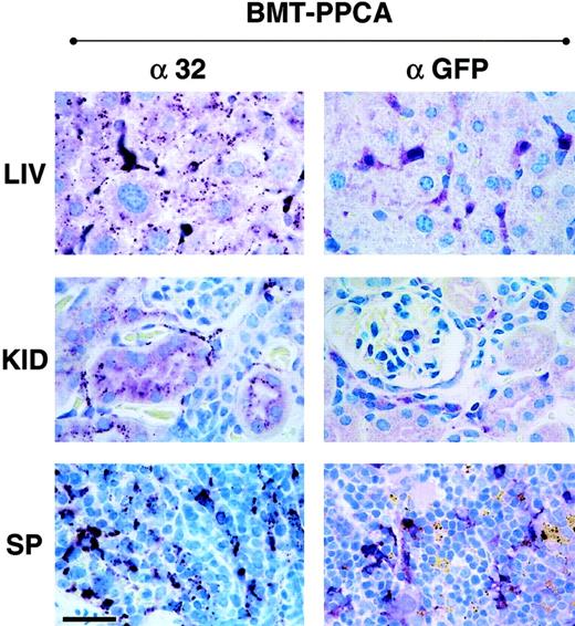 Fig. 3. Immunostaining of tissue sections from BM-transplanted GS mice with α-32 and α-GFP antibodies. / Numerous human PPCA-expressing cells were detected by immunostaining with α-32 antibody, monospecific for the human protein (left panels). In the liver of a BMT-treated mouse killed at 9 months after treatment, strong immunostaining was detected in Kupffer cells, as confirmed by staining of adjacent sections with the macrophage-specific anti–Mac-1 antibody. The clear punctate staining of the hepatocytes demonstrated internalization of the corrective enzyme by these cells. In the kidney the presence of the human PPCA was detected in the proximal convoluted tubules and Bowman capsule. Numerous macrophages and splenocytes in the spleen of transplanted mice were positive for the human protein. Staining of the same tissues with α-GFP antibody (right panels) was restricted to cells in locations consistent with their being of hematopoietic origin. Size bar corresponds to 30 μm.