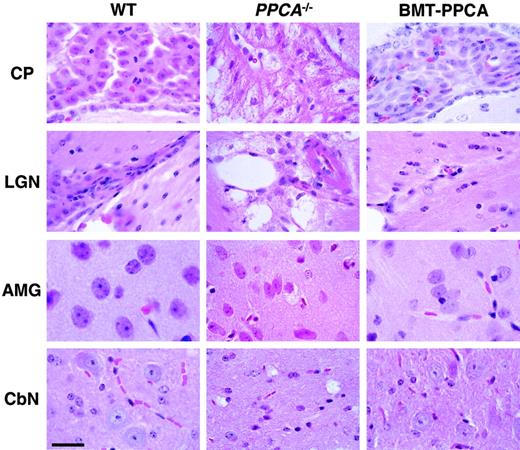 Fig. 4. Histology of 4 regions of the brain from BM-transplanted GS mice. / Hematoxylin and eosin staining of the choroid plexus (CP), the lateral geniculate nucleus (LGN), the amygdala (AMG), and the deep cerebellar nucleus (CbN) isolated from BMT-PPCA–treated GS mouse at 9 months after transplantation showed clear reduction of storage in neural cells compared to an age-matched GS animal. The overall brain architecture was clearly improved due to the clearance of storage material in endothelial cells and perivascular and leptomeningeal macrophages. Storage in some of the neurons in the amygdala and cerebellar nucleus was also cleared. Size bar corresponds to 30 μm.