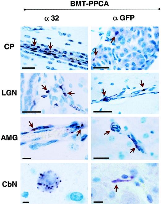 Fig. 5. Immunostaining of 4 brain regions from BM-transplanted GS mice with α-32 and α-GFP antibodies. / α-32 immunostaining of brain sections derived from BMT-PPCA–transplanted mice at 9 months after treatment revealed numerous PPCA+ endothelial cells, perivascular macrophages, sparse neurons as well as the cuboidal epithelium of the choroid plexus and its macrophages (indicated by arrowheads). Similar but more restricted immunostaining was detected in sections of the same regions stained with α-GFP antibody. Size bars correspond to 40 μm.