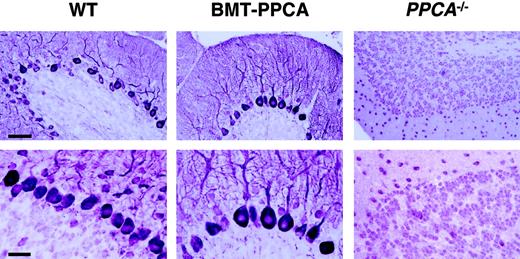 Fig. 6. PEP19 staining of cerebellar sections from BM-transplanted GS mice. / Serial sections of the cerebellum from a 9-month-old GS mouse transplanted with MSCV-PPCA–marked BM cells were stained with anti-PEP19 antibody. Note the dramatic loss of Purkinje cells in an age-matched GS mouse and the significant number of these cells that are retained in the treated animal. Size bars correspond to 60 μm for the upper panels and 30 μm for the lower panels.