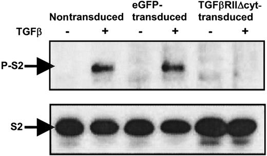 Fig. 4. Western immunoblotting shows absence of phosphorylated Smad2 in TGF-βRII-Δcyt–transduced CTLs with addition of TGF-β. / Nontransduced, eGFP-transduced, and TGF-βRII-Δcyt–transduced CTLs were incubated for 1 hour with 5 ng/mL TGF-β, as indicated. The presence or absence of Smad2 (S2) and phosphorylated Smad2 (P-S2) was detected by Western immunoblotting by using anti-Smad2 and antiphospho-Smad2 antibodies, respectively.