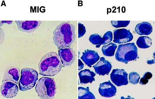 Fig. 3. Altered differentiation of cultured p210-transduced CB cells as shown by Wright staining. / Representative cytospins prepared from 7 day-old serum-free cultures of MIG (A) and p210-transduced (B) (GFP+) CD34+ CB cells maintained in FL, SF, IL-3, IL-6, and G-CSF but no added epo. These show the prevalence of recognizable granulocyte (metamyelocyte, band forms) and erythroid (basophilic erythroblasts) precursors, respectively, in the cultures initiated with these 2 types of cells (× 400 magnification). At later times, large numbers of polychromatophilic erythroblasts were also seen in the cultures of p210-transduced cells.