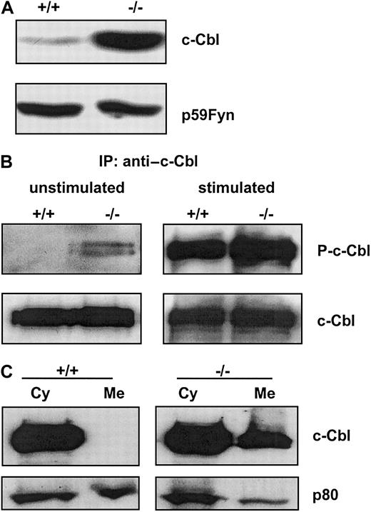 Fig. 4. Expression, phosphorylation, and subcellular distribution of c-Cbl in ICSBP+/+ and ICSBP−/− BMMs. / Cells were deprived of CSF-1 for 16 hours, harvested, and lysed in RIPA buffer. (A) Total cell extracts of 5 × 105 cells were subjected to western blotting with anti–c-Cbl antibody. Anti-Fyn antibody was used as control. (B) BMMs deprived of CSF-1 for 16 hours were left untreated or were stimulated for 4 minutes with 200 ng/mL CSF-1 at 37°C. Total cell extracts (1.5 mg) were used for immunoprecipitation with a c-Cbl antibody. The precipitates were subjected to western blot analyses with an antiphospho-tyrosine antibody (upper panels). After stripping the membrane was probed with an anti–c-Cbl antibody (lower panels). (C) BMMs continuously grown in the presence of 20 ng/mL CSF-1 were fractionated as described in “Materials and methods.” A quantity of 25 μg of membrane (Me) and cytosolic fraction (Cy) were subjected to western blotting with an anti–c-Cbl antibody (upper panel). Equal protein loading was controlled by the detection of p80 with the anti-ICSBP antiserum (lower panel).