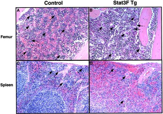 Fig. 3. Pathologic analysis of bone marrow and spleen in the Tg mice. / Hematoxylin–eosin-stained sections from the femurs of a wild-type littermate (A) and Stat3F Tg mice (B) and from the spleens of a wild-type littermate (C) and the Tg mice (D). Arrows show mature megakaryocytes (original magnification, ×100).