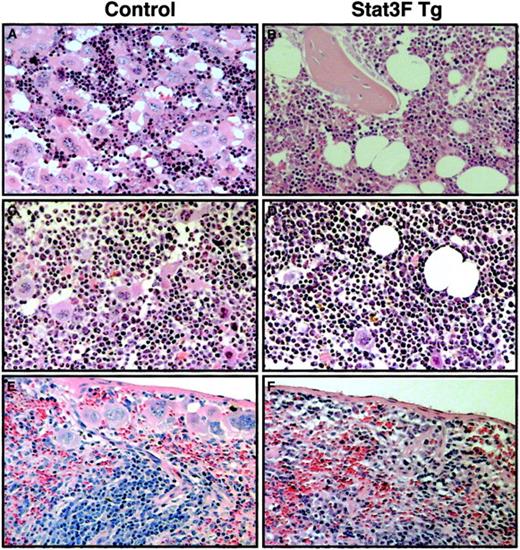 Fig. 8. Histopathologic analysis of bone marrow and spleen of Tg mice after 5-FU injection. / Hematoxylin–eosin-stained sections from the femurs of a wild-type littermate (A, C) and Stat3F Tg mice (B, D). Sections were prepared at day 7 (A, B) or day 10 (C, D) after 5-FU injection. Histologic analysis of the spleens from wild-type (E) and Tg mice (F) was also performed at day 10 after 5-FU injection. Original magnification, ×100