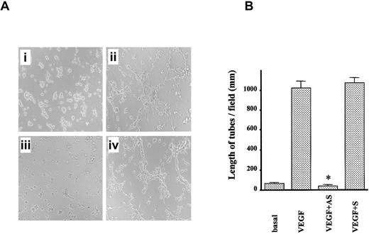 Fig. 8. Role of mPILSAP in angiogenesis in vitro. / The mPILSAP is required for angiogenesis in vitro. (A) Network formation by MSS31 cells was examined as described in “Materials and methods.” AS-ODN inhibited VEGF-induced network formation (×40 magnification). (B) Values are means and SDs of 6 fields. *Significant difference compared with the value for the corresponding VEGF-stimulated group (P < .001).