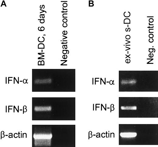 Fig. 2. Expression of IFN-α and IFN-β mRNA in sDCs and BM-DCs. / (A) BM-DCs. DCs were generated by culture of BM cells from B6 mice for 6 days in the presence of GM-CSF. CD11c+ cells were purified by means of MACS beads (greater than 98% CD11c+), and mRNA was extracted and assayed for IFN-α and IFN-β mRNAs by RT-PCR. As a negative control, 2 μL sterile water was used instead of cDNA template. (B) sDCs. The sDCs were purified from the spleens of B6 mice as described in “Materials and methods” (greater than 98% CD11c+) and immediately placed in lysis buffer. After cell lysis, the sample was treated with DNAse. Total RNA was then extracted and assayed for IFN-α and IFN-β mRNA by RT-PCR (left lane). The negative control (right lane) corresponds to 2 μL total RNA subjected to direct PCR (ie, without reverse transcription) using the same IFN-α and IFN-β primers. Amplified products were separated by electrophoresis on a 1.2% agarose gel in the presence of molecular markers (not shown).