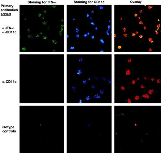 Fig. 5. Expression of IFN-α by sDCs. / The sDCs were purified from B6 mice, incubated for 1 hour in medium containing GolgiPlug, placed on microscope slides, and fixed. In the upper row, cells were stained with rat antimouse IFN-α and biotinylated hamster antimouse CD11c followed by FITC-conjugated anti–rat immunoglobulin and Cy5-conjugated streptavin. Staining of cells in the middle row was done in the same manner, except that rat antimouse IFN-α was omitted, while in the lower row primary antibodies were replaced by isotype-matched controls. Cells were analyzed by confocal microscopy, where staining with FITC appears green. Cy5 staining was given a “false” blue color in the middle column and appears as a “true” red color in the right column. Colocalization of FITC and Cy5 staining appears yellow in the overlay. Magnification × 63 for all images.