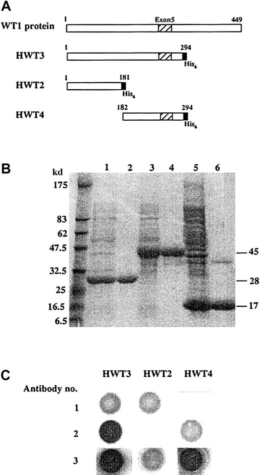Fig. 1. Structures and antigenicities of truncated recombinant WT1 protein. / (A) Structures of the whole WT1 protein and of the His-tagged truncated recombinant WT1 protein HWT3 that was used as a WT1 antigen to detect WT1 antibodies. (B) SDS-PAGE analysis of truncated recombinant WT1 proteins. Lanes 1, 3, and 5: lysate of induced bacteria containing HWT2, HWT3, and HWT4, respectively. Lanes 2, 4, and 6: affinity-purified HWT2, HWT3, and HWT4, respectively. (C) Truncated recombinant WT1 proteins HWT3, HWT2, and HWT4 were reacted on a nitrocellulose membrane with anti-WT1 polyclonal antibody, WT180 (1), anti-WT1 monoclonal antibody against exon 5, 1B6 (2), or anti-His-tag antibodies (3), and dot spots were visualized as described in “Patients, materials, and methods.”