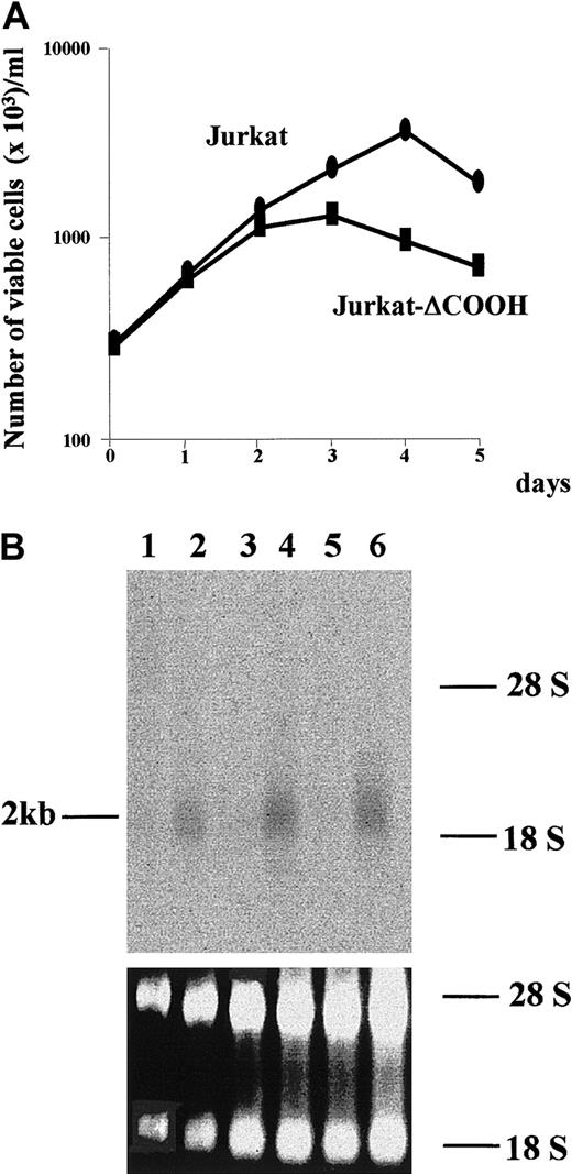 Fig. 1. hIAN1 mRNA expression in Jurkat and Jurkat-ΔCOOH. / (A) Growth analysis of Jurkat and Jurkat-ΔCOOH. The cells were cultured in RPMI 1640 containing 10% FCS and counted daily for 5 days. Viable cells represented trypan blue–negative cells that do not display any characteristic features of cells undergoing apoptosis. ● indicates Jurkat; ■, Jurkat-ΔCOOH. (B) Northern blot analysis of hIAN1 mRNA expression in Jurkat and Jurkat-ΔCOOH. The blot contained 5 μg total RNA isolated from Jurkat (odd lanes) and Jurkat-ΔCOOH (even lanes) at days 0 (lanes 1 and 2), 1 (lanes 3 and 4), and 3 (lanes 5 and 6) of culture and was hybridized with a radiolabeled 441-bpDpnII-DpnII fragment of the hIAN cDNA. The amount of RNA loaded in each lane was assessed by 18S and 28S staining.