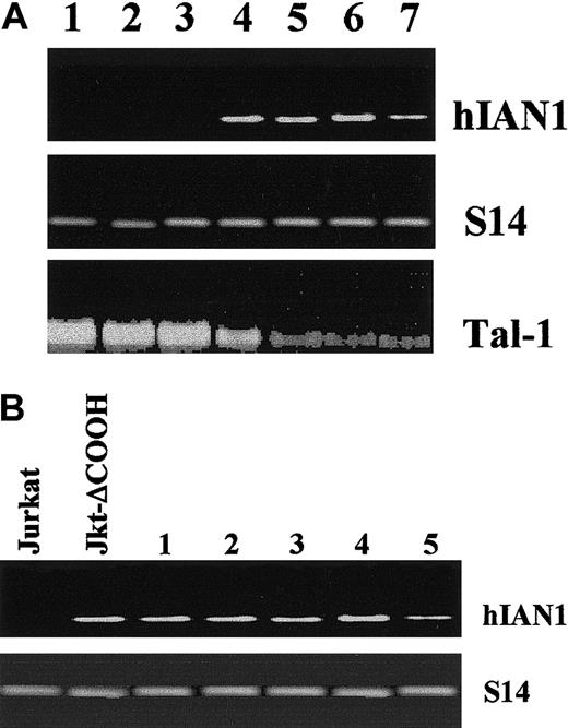 Fig. 3. hIAN1 and tal-1 mRNA expression in T-ALL. / (A) The hIAN1 and tal-1 mRNAs levels are reciprocally correlated. Northern blot analysis of hIAN1 and TAL-1 mRNA expression was performed on DU528 and Molt-4 (lanes 1 and 2), 2 T-ALL–derived cell lines that expressed TAL-1 after chromosomal rearrangement (DU528) or by a presently unknown mechanism (Molt-4); and on CEM and RPMI 8402 (lanes 5 and 6), and on 2 T-ALL–derived cell lines that harbor the sil-tal rearrangement. Jurkat and Jurkat-ΔCOOH cell lines (lanes 3 and 4) were used as controls. (B) Forced expression of TAL-1 in Jurkat-ΔCOOH does not modulate hIAN1 gene expression. Jurkat-ΔCOOH cells were transfected with a tal-1 expression vector, and 5 subclones (numbered 1 to 5) that expressed various levels of TAL-1 were selected. Total RNAs from Jurkat, Jurkat-ΔCOOH, and the 5 subclones were extracted, and hIAN1 mRNA level was studied by semiquantitative RT-PCR. The amount of cDNA used for PCR was normalized relative to the levels of the S14 gene product.