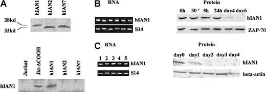 Fig. 9. Modulation of hIAN1 protein level during T- and B-lymphocyte activation. / (A) The hIAN1, hIAN2, and hIAN7 cDNAs were in vitro transcribed/translated as described in “Materials and methods,” and the 35S-labeled protein products were run on a 10% SDS-PAGE. The same in vitro–translated products together with total protein extracts of Jurkat and Jurkat-ΔCOOH were run on a 10% SDS-PAGE, blotted, and revealed by the anti-hIAN1 antiserum. (B) T lymphocytes were purified from human peripheral blood and activated with anti-CD28 and anti-CD3. Before activation (lane 1), and 30 minutes (lane 2), 5 hours (lane 3), 1 day (lane 4), 4 days (lane 5), and 6 days (lane 6) after activation, total RNA was extracted from half of the culture and protein extract was performed on the other half. Semiquantitative RT-PCR analysis was performed in the linear range of amplification, and Western blot analysis was performed by means of the anti-hIAN1 antiserum. The loading control for the Western blot was obtained with the use of an anti-ZAP70 antibody.25 (C) B lymphocytes were purified from human PBMCs and activated with 10 mg/mL IL-4 and irradiated (75 Gy) murine L cells that expressed the human CD40 ligand. RNAs and proteins were studied before activation (lane 1) and 1 day (lane 2), 2 days (lane 3), 3 days (lane 4), and 4 days (lane 5) after activation as described in panel B; the loading control for the Western blot was an anti–β-actin antibody.
