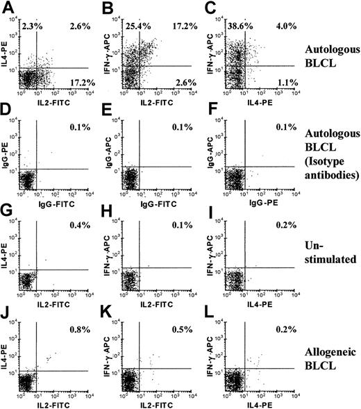 Fig. 4. Cytokine expression by PD-F4 cells. / PD-F4 cells coexpressed cytokines. Expression of IFN-γ, IL-2, and IL-4 was examined by flow cytometric analysis in PD-F4, which was stimulated with autologous BLCLs (panels A-C), no stimulators (panels G-I), or allogeneic BLCLs (panels J-L) for 5 hours in the presence of BFA. A gate was placed on CD4+ events. Panels D-F are for PD-F4 stimulated as for panels A-C, but stained with respective control isotype antibodies. A representative of 5 independent experiments is shown.