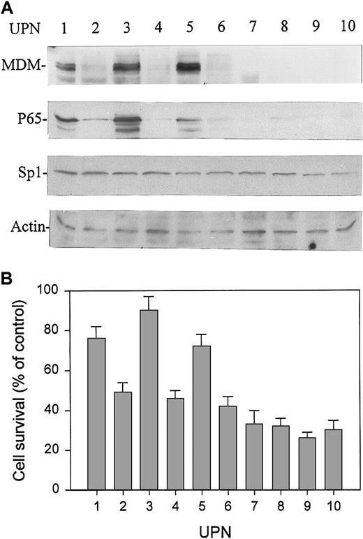 Fig. 1. Expression of MDM2, p65, and Sp1 proteins and sensitivity to doxorubicin in primary leukemia cells from 10 randomly selected patients with BCP-ALL. / (A) Expression of MDM2, p65, and Sp1 proteins in marrow mononuclear cells (more than 90% leukemic blasts) from pediatric patients with ALL was analyzed by Western blot assay. (B) Response to doxorubicin of leukemic cells from the same samples examined for MDM2, p65, and Sp1 protein expression. Cells were cultured with doxorubicin at 1 μM for 48 hours, and cell survival (viability) was determined by XTT assay. Viability was expressed as percentage of control (ie, cultures without doxorubicin). Data represent mean ± SD detected in triplicate experiments. UPN, unique patient number.