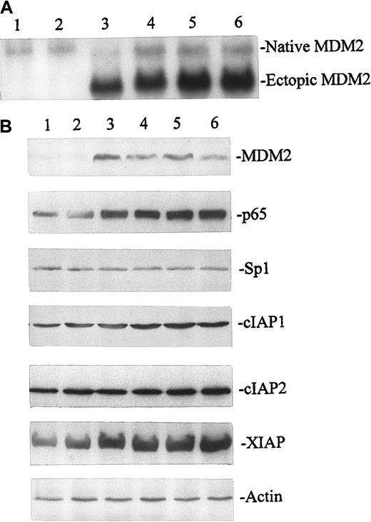 Fig. 2. Stable expression of transfected (ectopic) MDM2 and its effect on the expression of p65, Sp1, and NFκB-regulated gene products cIAP1, cIAP2, and XIAP. / MDM2 mRNA in EU-4 cells was detected by Northern blot assay (A), and the protein levels of MDM2, p65, Sp1, cIAP1, cIAP2, and XIAP in MDM2-transfected and control cells were detected by Western blot assay (B). Total RNA and protein were extracted simultaneously from parental EU-4 cells (lane 1) and EU-4 cells stably transfected with either pCMV plasmid-neo alone (lane 2) or pCMV-MDM2 (lanes 3-6). Stably transfected cells were derived from G418-resistant single clones maintained in culture for 3 months. Northern blot and Western blot analyses were performed as described in “Materials and methods.”