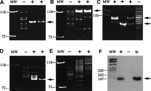 Fig. 2. PCR of microdissected bcl-2+ and bcl-2−follicles from 5 cases. / (A-E) IgH− FRIII PCR. (F) BCL2/JHPCR. (A,F) Case no. 17. (B) Case no. 8. (C) Case no. 11. (D) Case no. 6. (E) Case no. 2. MW indicates molecular weight standard; +, microdissected bcl-2+ follicles; –, microdissected bcl-2− follicles; W, whole intact tissue section without microdissection. In case nos. 17, 8, 11, and 6, reproducible single or double discrete clonal bands (arrows) with or without a background ladder were generated from bcl-2+ GCs, whereas a polyclonal ladder was generated from bcl-2− GCs. Case no. 11 (C) contained 2 separate distinct clonal bands. Case no. 2 (E) showed a polyclonal ladder pattern from both bcl-2+ and bcl-2− follicles. (F) A BCL-2 gene rearrangement at the major breakpoint region was identified from microdissected bcl-2+ GCs (+) and the whole (W) intact tissue section without microdissection, but was negative in bcl-2− (−) GCs (case no. 17).