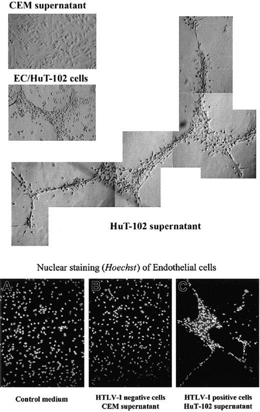 Fig. 5. Effect of HTLV-I–positive cells or cell supernatant on Matrigel-induced tube formation of endothelial cells in vitro. / Endothelial cells (ECs) were plated on growth factor-reduced Matrigel in the presence of culture medium, HuT-102 cells, HuT-102 cellfree supernatant, and CEM cellfree supernatant. Plates were photographed using light and fluorescence microscopy (magnification × 20) and Hoechst nuclear staining.