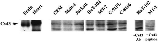 Fig. 7. Detection of connexin-43 protein expression. / Total cell extracts from HTLV-I–transformed cells (HuT-102, MT-2, C8166, C91PL) and HTLV-I–negative cells (Jurkat, CEM, Molt4) were analyzed by Western blot using anti-Cx43–specific antibodies. Rat brain and heart extracts were used as positive control. Specificity was demonstrated by competition with Cx43 peptide or omission of anti-Cx43 primary antibody.