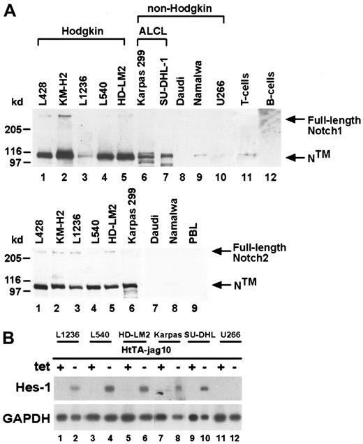 Fig. 2. High Notch1 and Notch2 expression in cultured HRS and ALCL cells. / (A) Upper panel: Western blot analysis of cell lysate proteins from Hodgkin (lanes 1-5) cell lines, non-Hodgkin (lanes 6-10) cell lines, mature CD2+ T cells (lane 11), and mature CD19+B cells (lane 12) showing bands of full-length Notch1 (300 kd) and 110-kd major cleavage product (NTM). Lower panel: Notch2 protein expression in cell lines indicated. (left margin) Size markers in kilodalton. (B) Cocultivation of HtTA-jag10 cells expressing the Notch1 ligand, Jagged1, under tetracycline control and lymphoma cells expressing various amounts of endogenous Notch1 receptors. Jagged1 expression in HtTA-jag10 cells was either uninduced (+tet) or induced (−tet). Northern blot analysis showing increased levels of endogenous Hes-1 transcripts in HRS (lanes 1-6) and ALCL cells (lanes 7-10) after activation by Jagged1. The myeloma cell line U266 served as a negative control (lanes 11, 12).