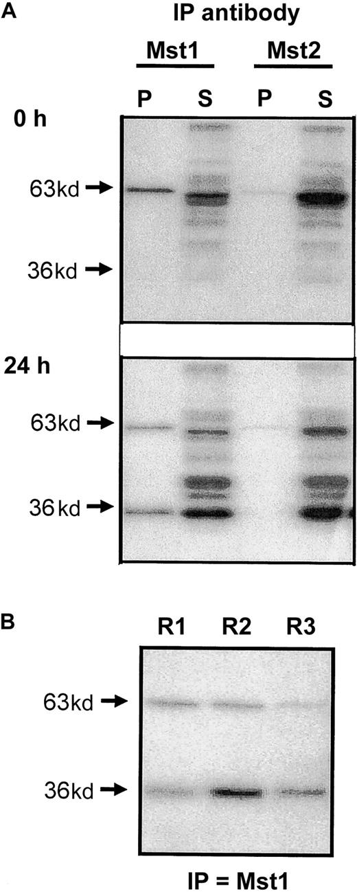 Fig. 4. Immunoprecipitation of Mst1 and Mst2 from apoptotic eosinophils. / (A) Eosinophil lysates were obtained from freshly purified eosinophils and from cells cultured for 24 hours in cytokine-free medium. Following immunoprecipitation with antibodies to the N-terminal catalytic fragments of Mst1 and Mst2, the pellet (P) and supernatant (S) fractions were separated on 10% gels by SDS-PAGE and the kinase activities measured by “in gel” renaturation assays using MBP as a substrate. (B) Supernatant obtained following initial immunoprecipitation (R1) was immunoprecipitated for a second (R2) and third (R3) time using the antibody to Mst1 and the activity in the pellets determined by MBP “in gel” renaturation assay. Representative autoradiographs are presented and are typical of 3 independent experiments.