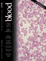 Blood Cover Image for Volume 100, Issue 10