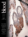 Blood Cover Image for Volume 102, Issue 5
