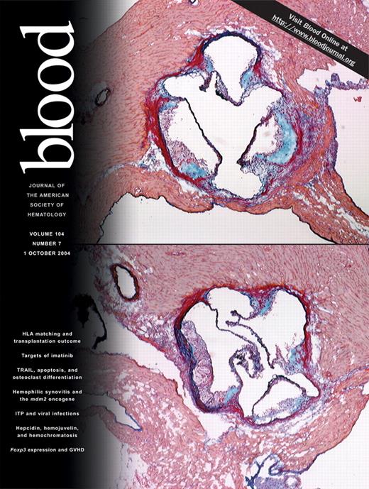 Blood Cover Image for Volume 104, Issue 7