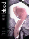 Blood Cover Image for Volume 105, Issue 1