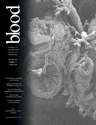 Blood Cover Image for Volume 105, Issue 11