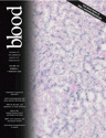 Blood Cover Image for Volume 105, Issue 3