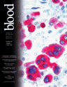 Blood Cover Image for Volume 105, Issue 7