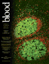 Blood Cover Image for Volume 109, Issue 4