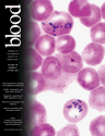 Blood Cover Image for Volume 109, Issue 8