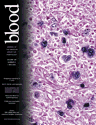 Blood Cover Image for Volume 109, Issue 9